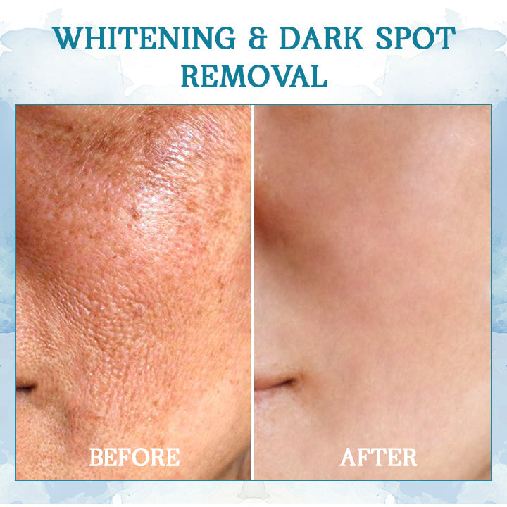 SAFDF™ LuxeLift Skin Firming Youth Butter🔥Best-Selling🔥